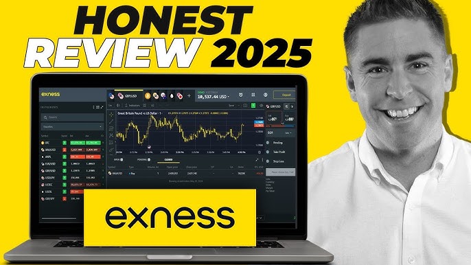 Choosing the Right FX Broker for Your Trading Needs 11